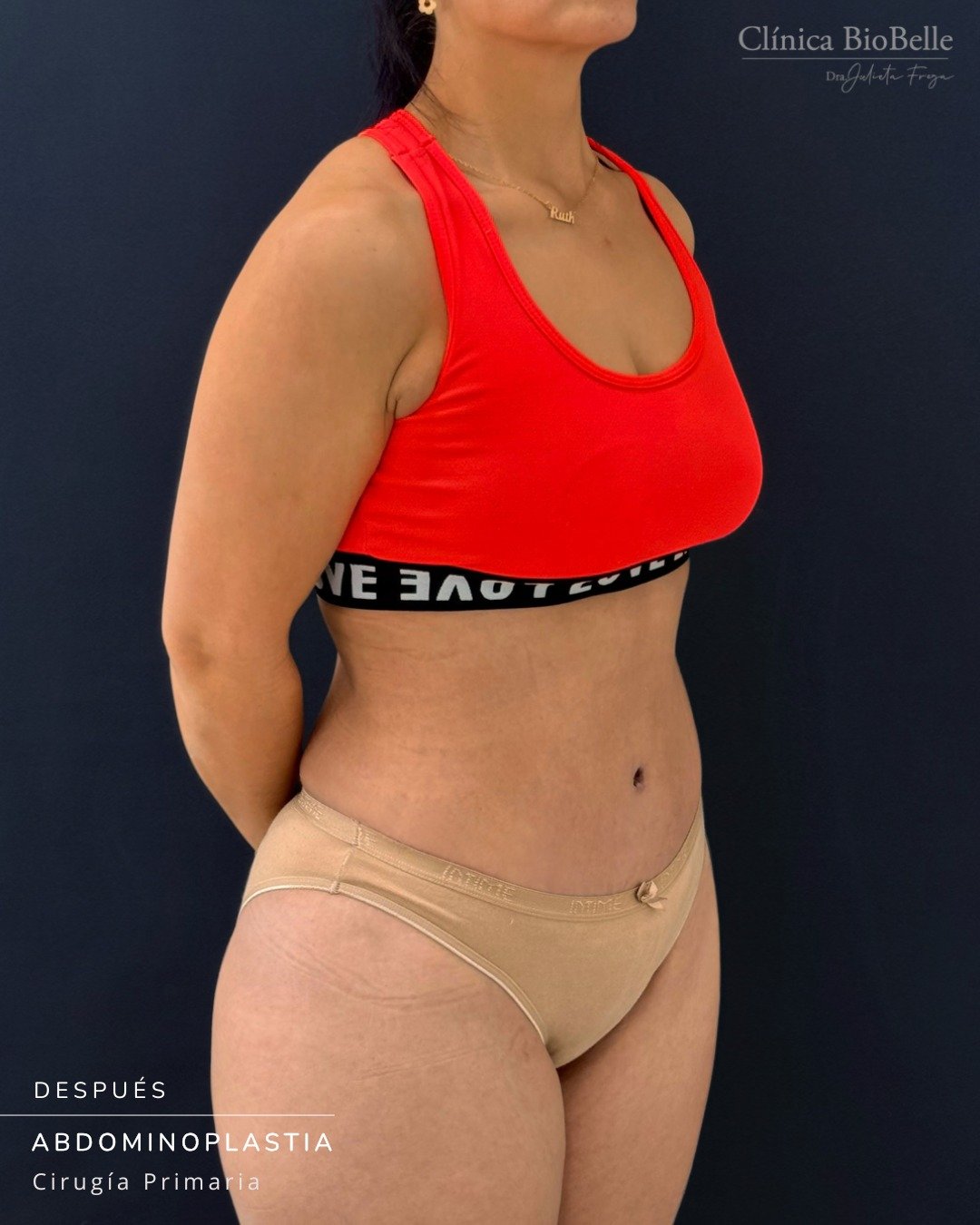 Abdominoplastia ✨
¡Miren la increíble transformación de nuestra paciente! 😍
Gracias por permitirnos compartir tu evolución y por confiar en nuestro equipo para lograr tus objetivos.
Si quieres conocer más sobre este procedimiento y cómo puede ayudarte, agenda tu evaluación médica con nosotros. 💌
📞 +569 6677 12 93
📍 La Concepción 141, Oficina 202 - Providencia