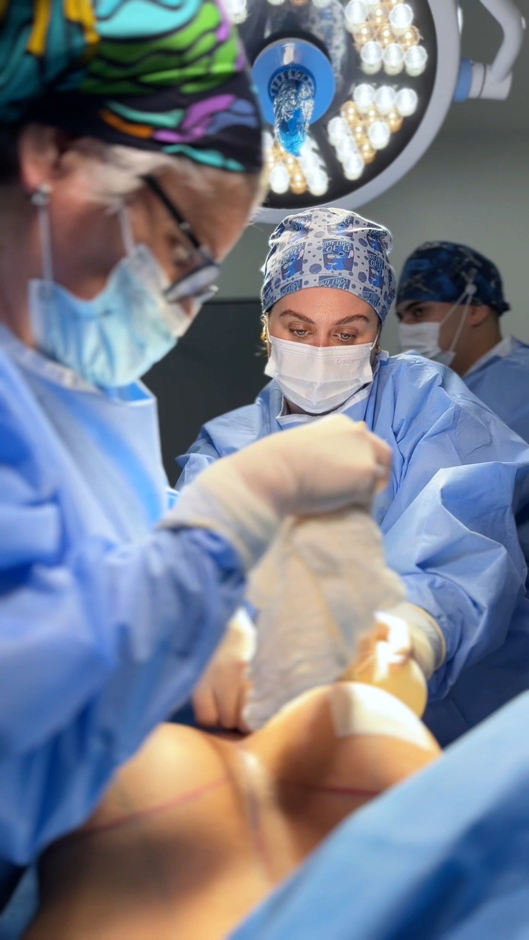 Recap de una de nuestras primeras cirugias del 2026.
Parte 1 - En estos dos casos de mamoplastia de aumento quieremos mostrarles algo muy importante:
🤍 no todas las pacientes son iguales.
Cada una tiene características anatómicas distintas: forma del tórax, calidad de piel, volumen mamario previo, posición del complejo areola-pezón y expectativas diferentes.
Por eso, aunque la cirugía se llame igual, la planificación nunca es la misma. El tipo de implante, el plano de colocación y la técnica quirúrgica se definen de manera totalmente personalizada.
✨ Si estás pensando en un aumento mamario, agenda tu evaluación y diseñemos juntas la mejor opción para ti.
📩 Envíame un mensaje directo o agenda a través del link en mi perfil