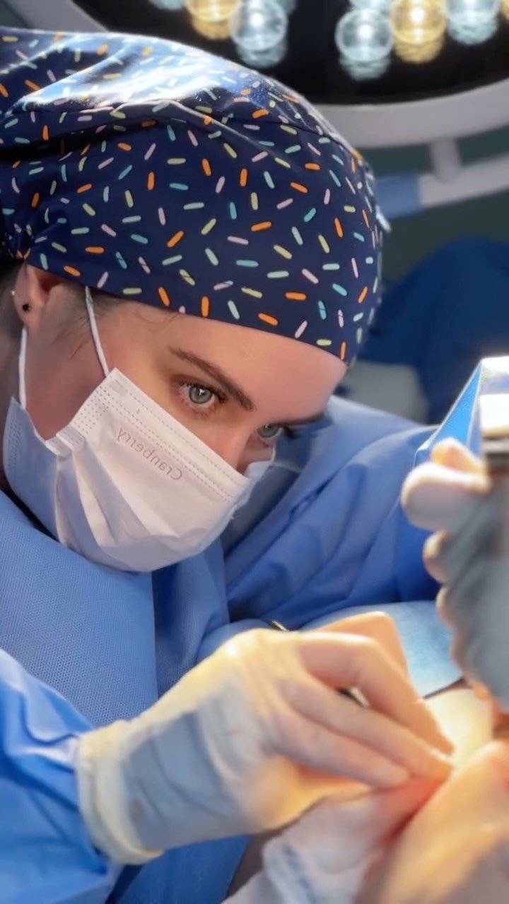 Cada uno de nuestros pacientes tiene una historia de vida única, y nos sentimos profundamente agradecidos de poder acompañarlos en este camino. 🤍
En esta oportunidad realizamos una cirugía mamaria reconstructiva en una paciente con antecedente de cáncer de mama, quien había sido sometida previamente a una mastectomía total de la mama izquierda.
Se efectuó el recambio del implante afectado por contractura capsular, junto con una cirugía de simetrización en la mama contralateral, buscando devolver armonía, comodidad y un resultado con el que la paciente pudiera sentirse bien nuevamente.
Porque detrás de cada cirugía, también hay un proceso de recuperación, fortaleza y confianza.
📩 Si deseas asistir a una evaluación médica, puedes enviarnos tu número de contacto para llamarte y coordinar tu cita o comunicarte a nuestro WhatsApp:
📲 +56 9 6677 12 93
📍 La Concepción 141, Oficina 202. Providencia