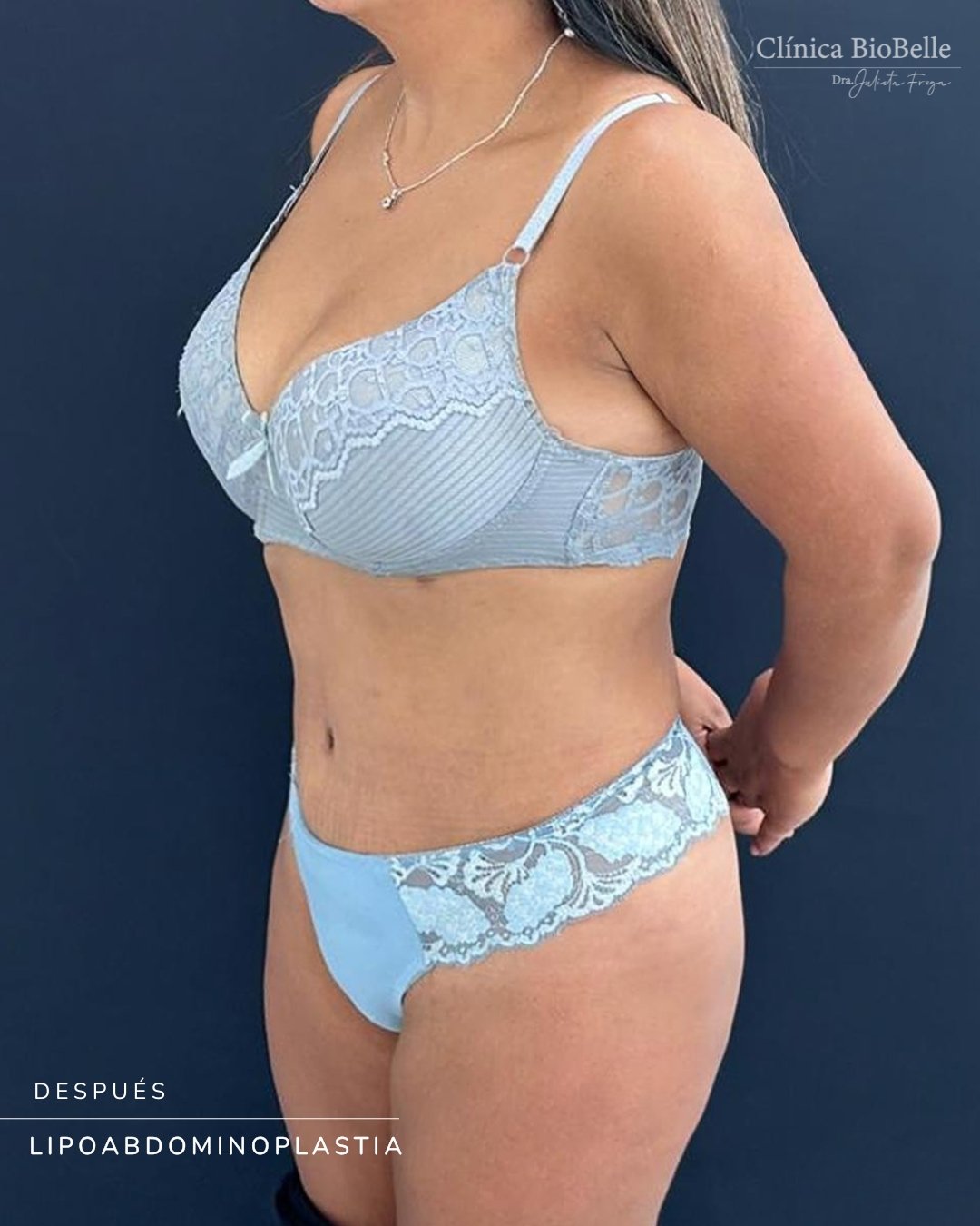Compartimos un caso de antes y después de una lipoabdominoplastia.

Cada procedimiento requiere evaluación clínica, indicación quirúrgica y planificación individualizada de acuerdo con las necesidades de cada paciente.

Desliza para ver el resultado.

#Lipoabdominoplastia #AntesYDespues #CirugiaCorporal #CirugiaPlasticaChile ClinicaBiobell